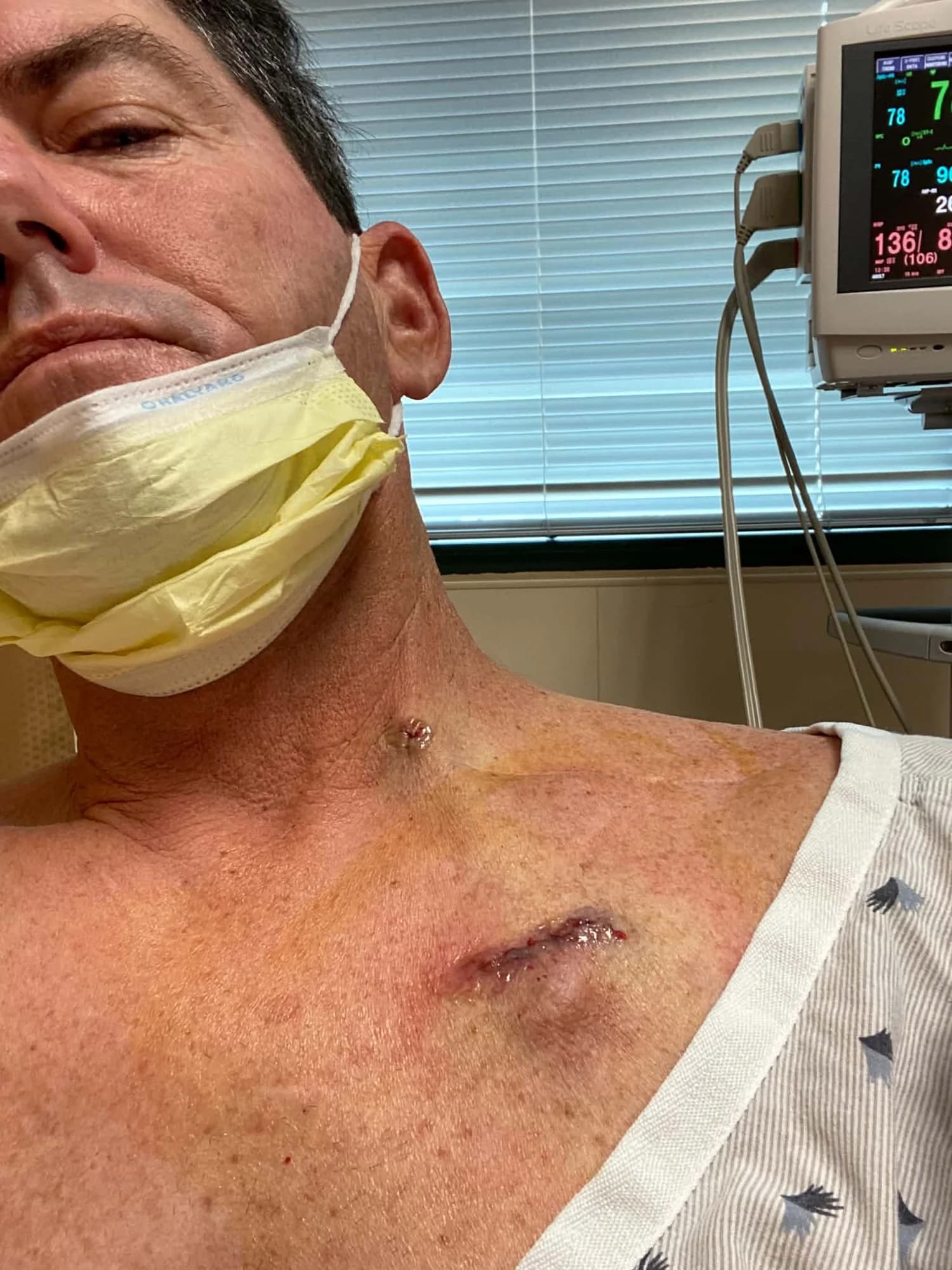 A healing scar on Frank's chest, with a hospital monitor behind him